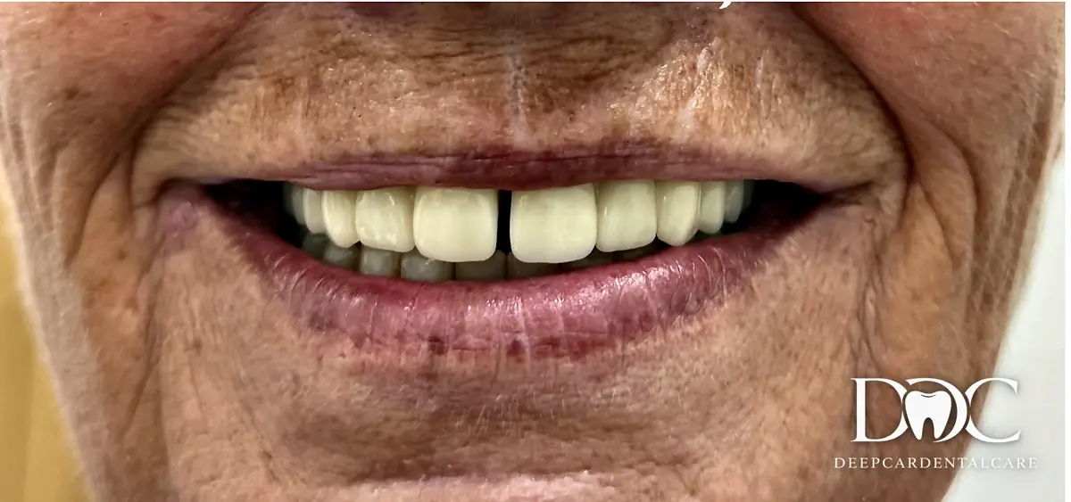 A restored smile